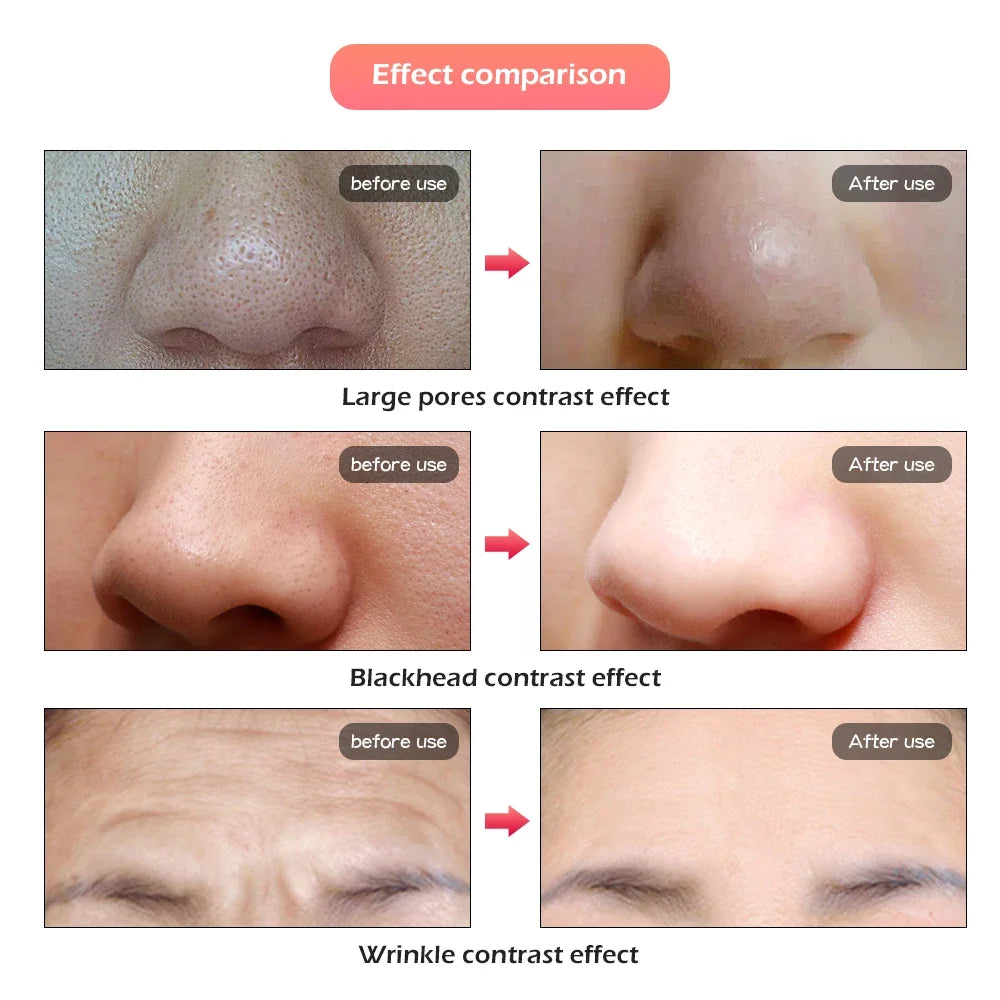 Phoenix Glow LED Face & Neck Mask with 7 lights