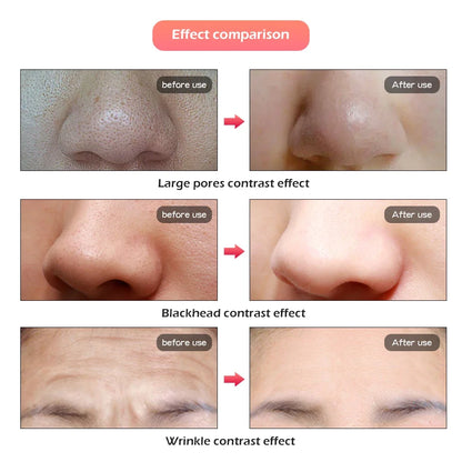 Phoenix Glow LED Face & Neck Mask with 7 lights